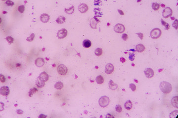 nucleated red cell