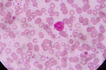 complete blood count