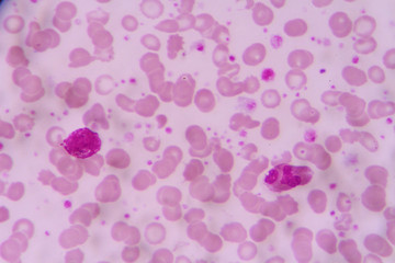 complete blood count