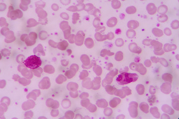 complete blood count
