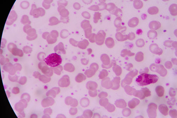 complete blood count