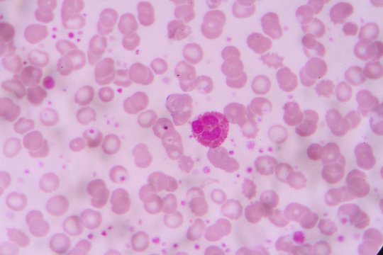 complete blood count
