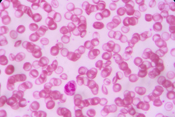 complete blood count