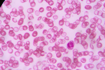 complete blood count