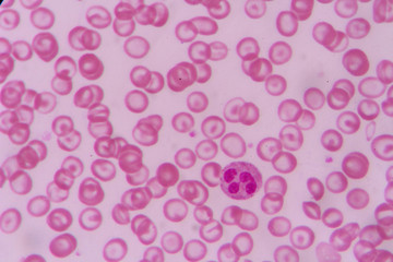 complete blood count