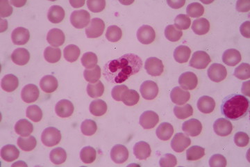 slide blood smear show white blood cell for complete blood count