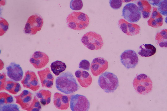 Eosinophil