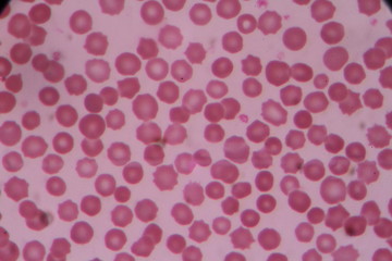 Normal red blood cells.