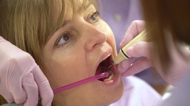 Woman at the dental hygienist and dentist clinic professional tooth whitening and ultrasound cleaning. Odontic and mouth health and hygiene is important part of human life that dentistry help with