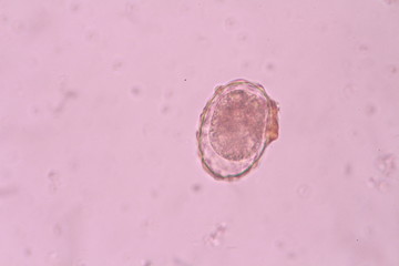 Ascaris lumbricoides
