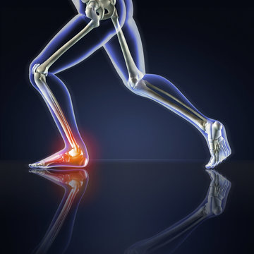 X-ray Runner with Ankle Pain