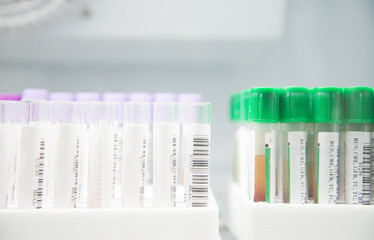 Blood test tube in laboratory.
