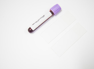 Blood test tube in laboratory.