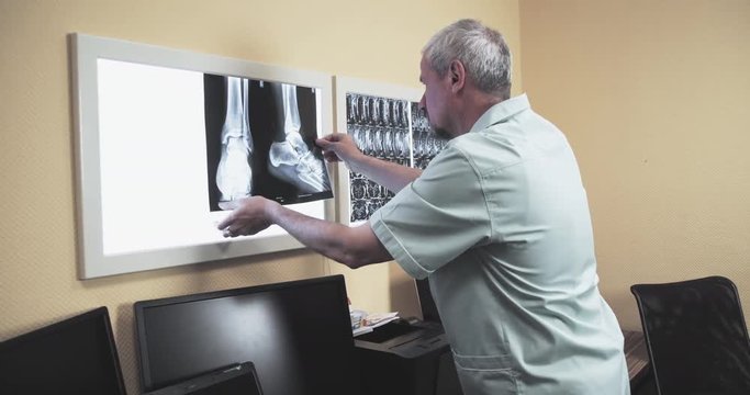 Male doctor reviewing x-ray 4k video. Orthopedist puts xray leg foot scan image on illuminator panel and searching diagnosis