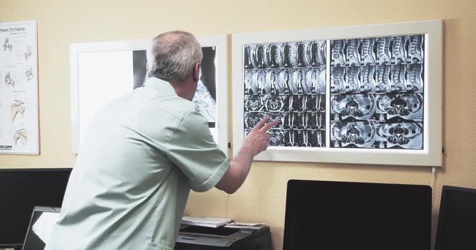 Male doctor reviewing CT MRI images 4k video. Orthopedist looks on x-ray scan image on illuminator panel and searching diagnosis