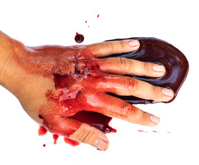 Hand of man injured wound from accident and blood bleeding on wh