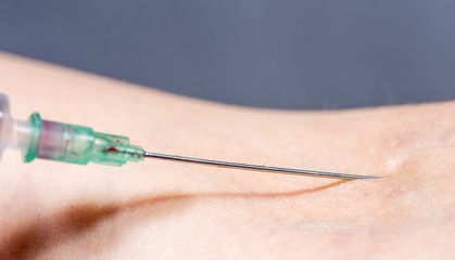 eine Injektionsnadel wird in einen Arm gestochen