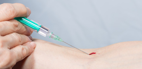 eine Injektionsnadel wird in einen Arm gestochen