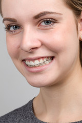 Junges Mädchen lächelt mit ihrer Zahnspange