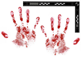 Bloody male hand prints with forensic scale