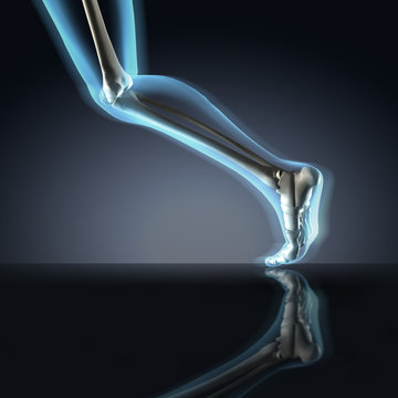X-ray of Running Leg