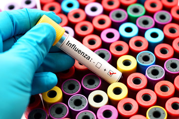 Blood sample positive with influenza virus