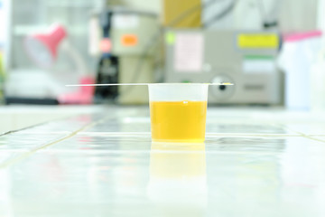 Urine sample for laboratory analysis
