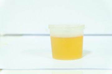 Urine sample for laboratory analysis