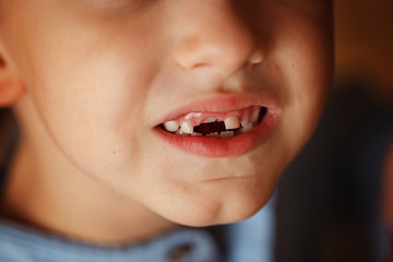 Fototapeta premium Fall out of the kids first tooth.