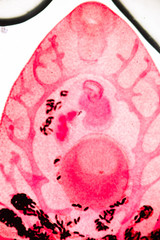 Fasciola gigantica (parasite) under the microscope