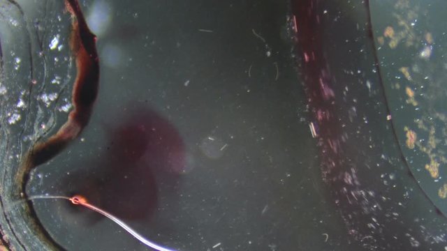 Blood Coagulates - Microscope 