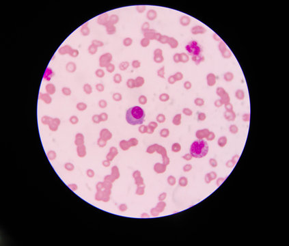 plasma cells