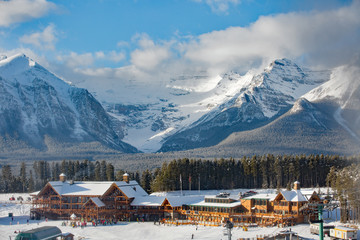 Lake Louise lodge with mountians behind 