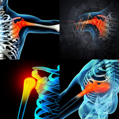 3d render human shoulder pain with the anatomy of a skeleton sho