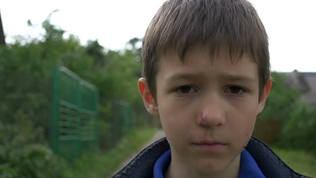 Angry Beaten Pained Boy on the Street closeup, Plans on Revenge