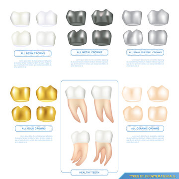 infographics types of dental crown materials with healthy teeth, ceramic, resin, metal and stainless-steel