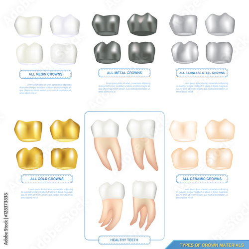 "infographics types of dental crown materials with healthy teeth