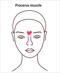 Женское лицо  и мимические мышцы, образующие морщины и складки. Старение лица