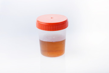 Medical Urine Specimen Jar