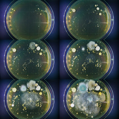 stage of the growth of microorganisms in the petri dish. Research of pathogens in a scientific laboratory