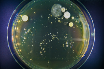 Petri dishes with growing microflora. Study hygiene premises restaurants. food safety