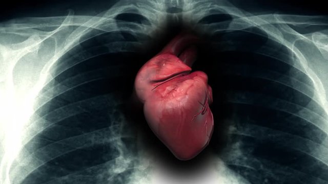 Human Heartbeat Inside Of X-Ray