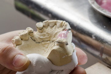 Dental technician doing partial dentures of acrylic resins.