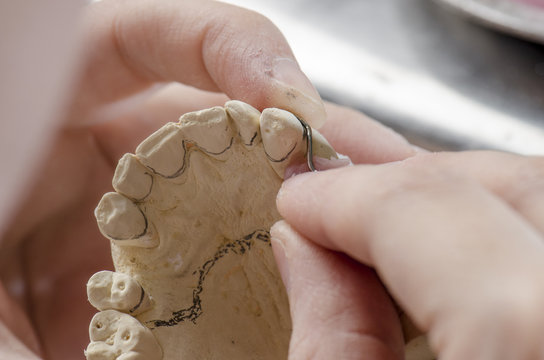 Dental technician doing partial dentures of acrylic resins.