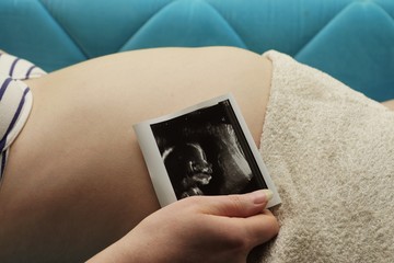 Pregnant woman with ultrasound image 