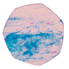 Micro bacterium tuberculosis 3+ moderate red cells on blue backg