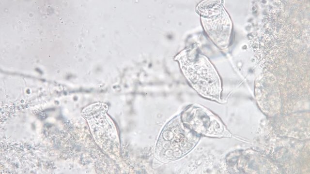 Living Vorticella is a genus of protozoan under microscope view.
