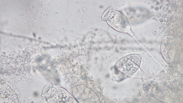 Living Vorticella is a genus of protozoan under microscope view.
