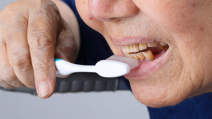elderly tooth attrition