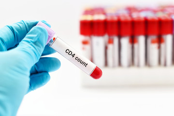 Naklejka premium Blood for CD4 count
